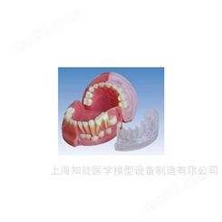 三岁乳恒牙交替解剖模型-三岁乳牙解剖模型-恒牙交替模型